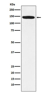 Anti-HTSF1 Rabbit Monoclonal Antibody Boster Bio