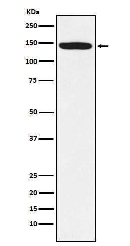 Anti-HTSF1 Rabbit Monoclonal Antibody Boster Bio
