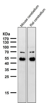 Anti-NeuroD2 Rabbit Monoclonal Antibody Boster Bio