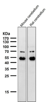 Anti-NeuroD2 Rabbit Monoclonal Antibody Boster Bio