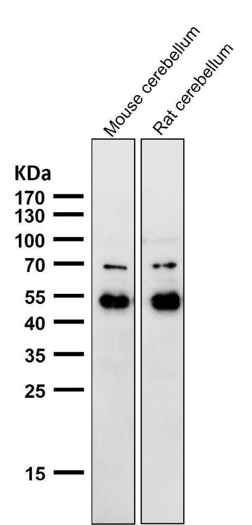 Anti-NeuroD2 Rabbit Monoclonal Antibody Boster Bio