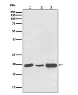Anti-NDUFB8 Rabbit Monoclonal Antibody Boster Bio