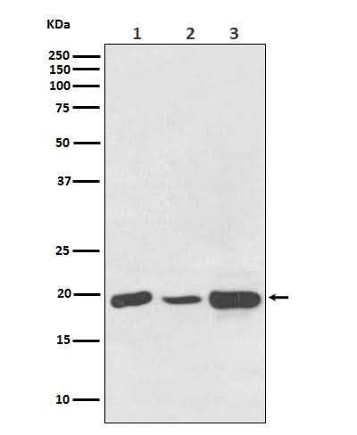 Anti-NDUFB8 Rabbit Monoclonal Antibody Boster Bio