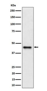 Anti-DAZAP1 Rabbit Monoclonal Antibody Boster Bio