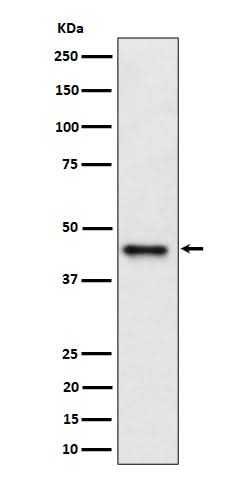 Anti-DAZAP1 Rabbit Monoclonal Antibody Boster Bio