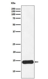 Anti-CRABP1 Rabbit Monoclonal Antibody Boster Bio