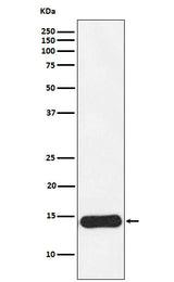 Anti-CRABP1 Rabbit Monoclonal Antibody Boster Bio