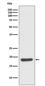 Anti-Hsp20 Rabbit Monoclonal Antibody Boster Bio