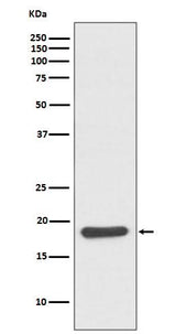 Anti-Hsp20 Rabbit Monoclonal Antibody Boster Bio