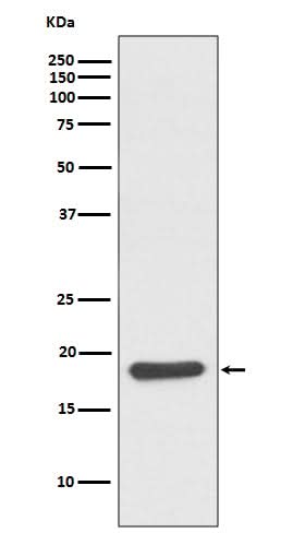 Anti-Hsp20 Rabbit Monoclonal Antibody Boster Bio