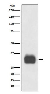 Anti-Mast Cell Tryptase Rabbit Monoclonal Antibody Boster Bio