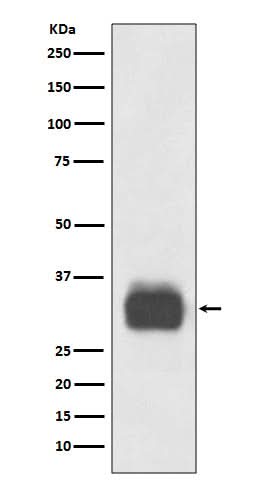 Anti-Mast Cell Tryptase Rabbit Monoclonal Antibody Boster Bio