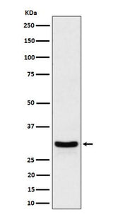 Anti-FRAT1 Rabbit Monoclonal Antibody Boster Bio
