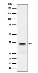 Anti-Lactate Dehydrogenase C Rabbit Monoclonal Antibody Boster Bio