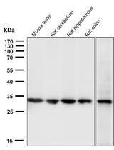 Anti-Calponin CNN1 Rabbit Monoclonal Antibody Boster Bio