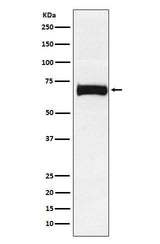 Anti-Nectin 2 Rabbit Monoclonal Antibody Boster Bio