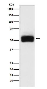 Anti-MMP17 Rabbit Monoclonal Antibody Boster Bio