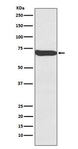 Anti-Frizzled 9 / CD349 Rabbit Monoclonal Antibody Boster Bio
