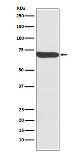 Anti-Frizzled 9 / CD349 Rabbit Monoclonal Antibody Boster Bio