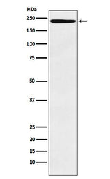 Anti-LY75 Monoclonal Antibody Boster Bio