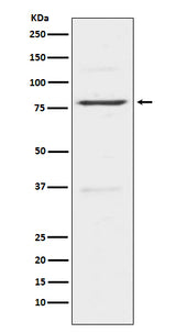Anti-Insulin Receptor R INSRR Monoclonal Antibody Boster Bio