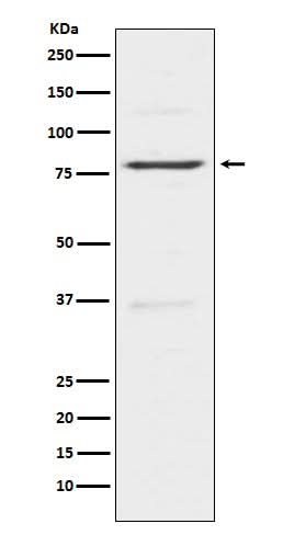 Anti-Insulin Receptor R INSRR Monoclonal Antibody Boster Bio