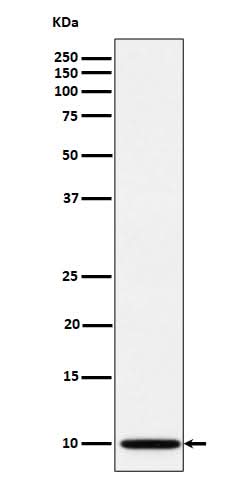 Anti-NDUFA1 Rabbit Monoclonal Antibody Boster Bio