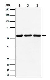 Anti-PRPF4 Rabbit Monoclonal Antibody Boster Bio