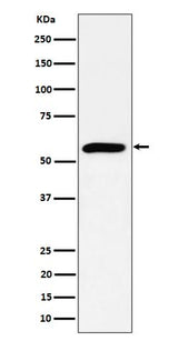 Anti-PRPF4 Rabbit Monoclonal Antibody Boster Bio