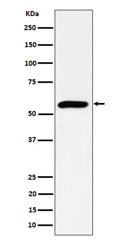 Anti-PRPF4 Rabbit Monoclonal Antibody Boster Bio