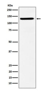 Anti-SF3B3 Rabbit Monoclonal Antibody Boster Bio