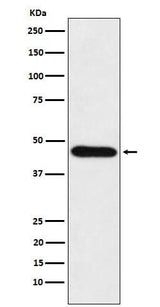 Anti-CDC123 Rabbit Monoclonal Antibody Boster Bio
