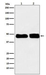 Anti-C4 binding protein Rabbit Monoclonal Antibody Boster Bio