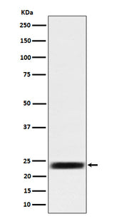 Anti-ARFRP1 / ARP Rabbit Monoclonal Antibody Boster Bio