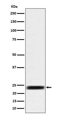 Anti-ARFRP1 / ARP Rabbit Monoclonal Antibody Boster Bio