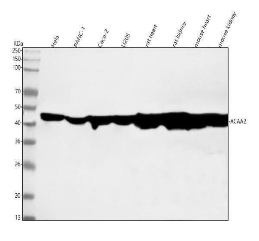 Anti-ACAA2 Rabbit Monoclonal Antibody Boster Bio