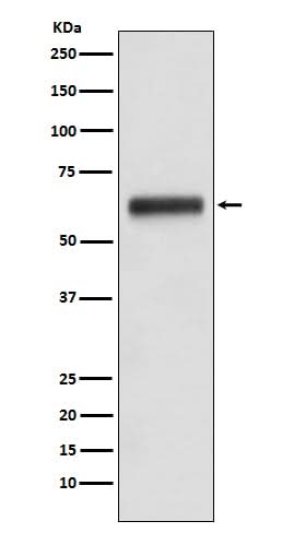 Anti-Human IgG3 IGHG3 Monoclonal Antibody Boster Bio