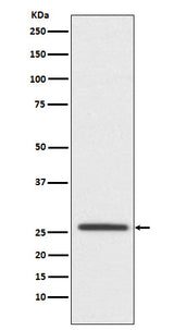 Anti-Claudin 11 CLDN11 Monoclonal Antibody Boster Bio