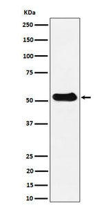 Anti-alpha Tubulin (acetyl K40) Rabbit Monoclonal Antibody Boster Bio