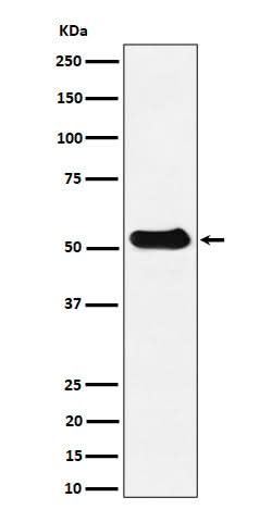 Anti-alpha Tubulin (acetyl K40) Rabbit Monoclonal Antibody Boster Bio