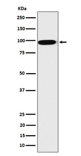 Anti-CLPTM1 Rabbit Monoclonal Antibody Boster Bio