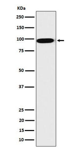 Anti-CLPTM1 Rabbit Monoclonal Antibody Boster Bio