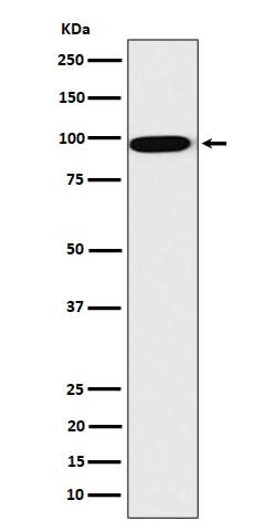 Anti-CLPTM1 Rabbit Monoclonal Antibody Boster Bio
