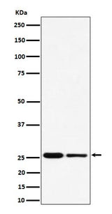 Anti-PMF1 Rabbit Monoclonal Antibody Boster Bio