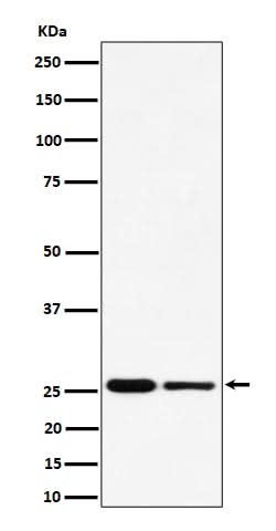 Anti-PMF1 Rabbit Monoclonal Antibody Boster Bio