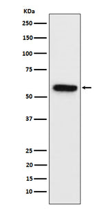 Anti-Synapsin II Rabbit Monoclonal Antibody Boster Bio