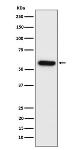 Anti-Synapsin II Rabbit Monoclonal Antibody Boster Bio