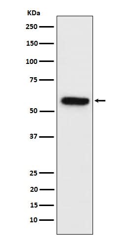 Anti-Synapsin II Rabbit Monoclonal Antibody Boster Bio