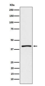 Anti-ATP1B3 Rabbit Monoclonal Antibody Boster Bio