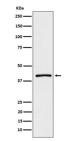 Anti-ATP1B3 Rabbit Monoclonal Antibody Boster Bio